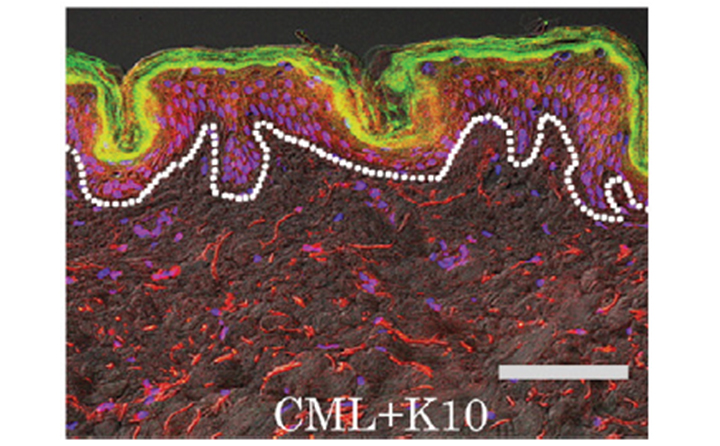 エイジソリューションクリーム リニューアル記念イベントレポート