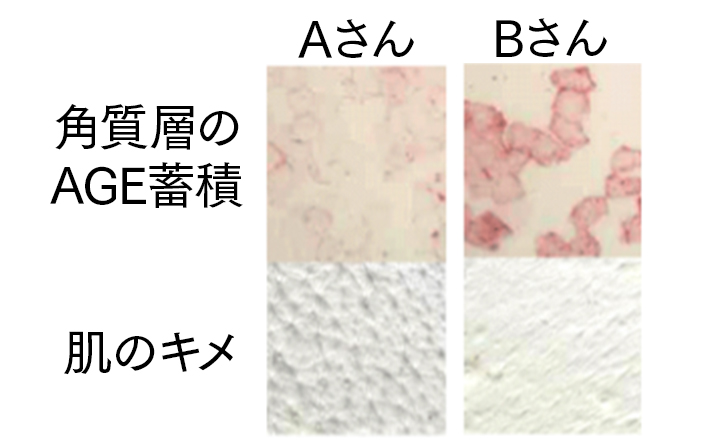 エイジソリューションクリーム リニューアル記念イベントレポート